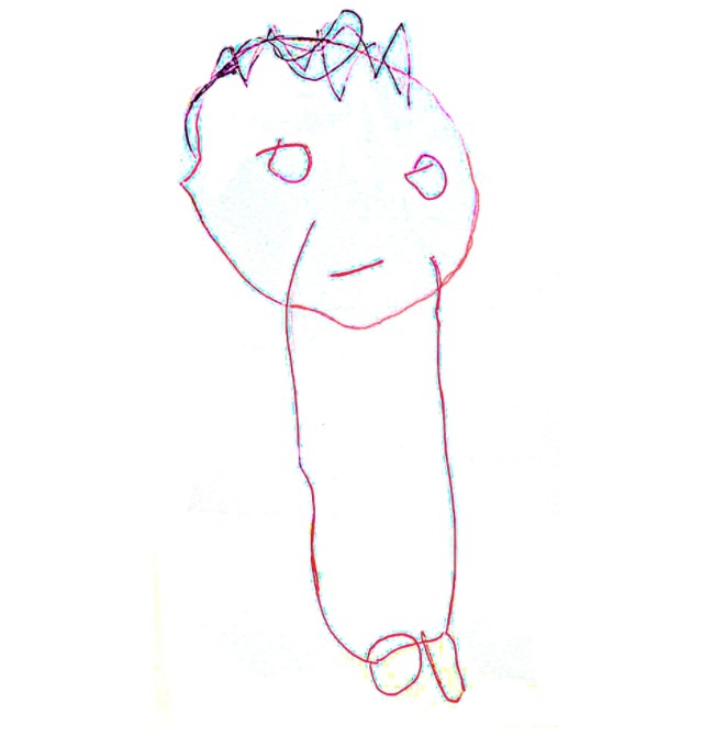 Harry